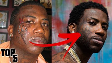 where did guccis face tattoo go|Gucci mane before and after.